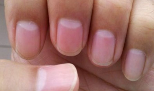 指甲上的“月牙”越多越健康？